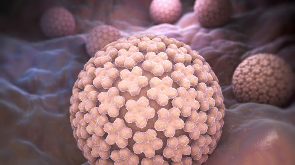 ویروس پاپیلوماویروس انسانی ، درمان زگیل تناسلی