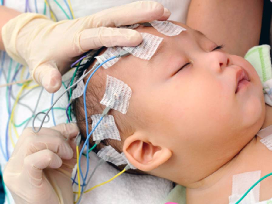 تست نوار عصب و عضله برای کودک