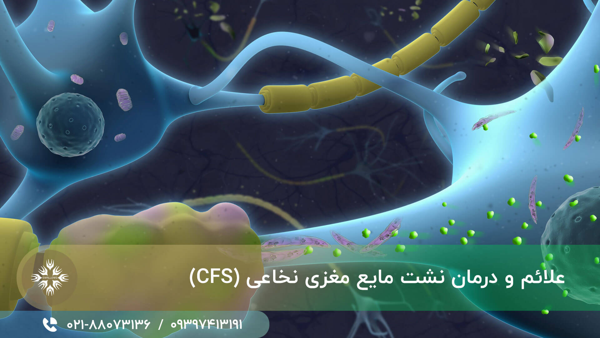 مایع مغزی نخاعی