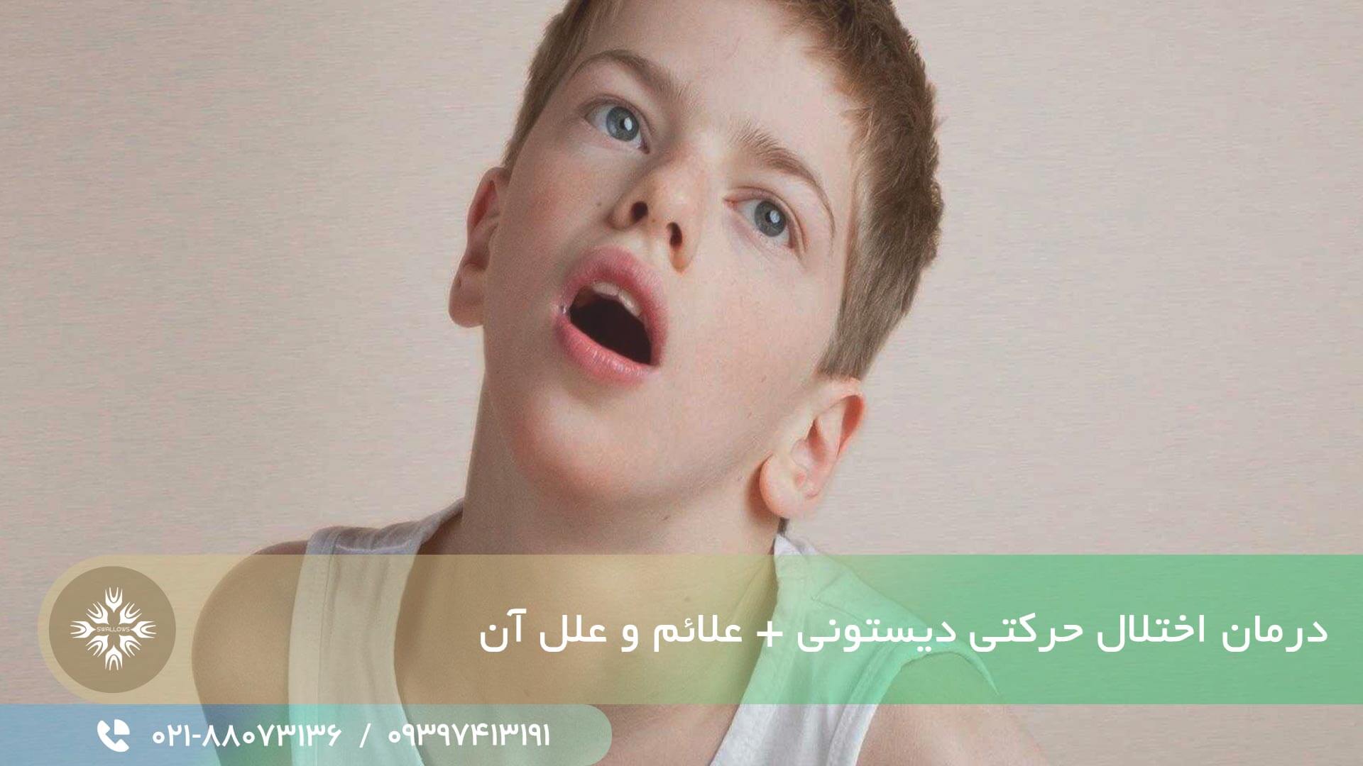 اختلال حرکتی