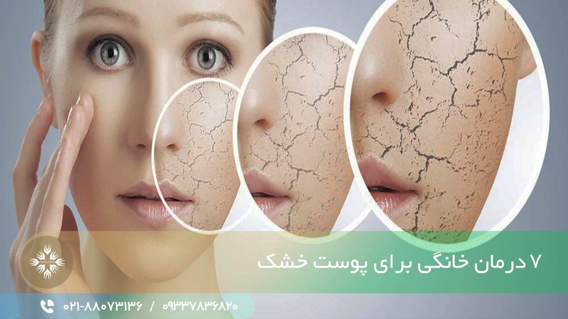درمان خانگی پوست خشک