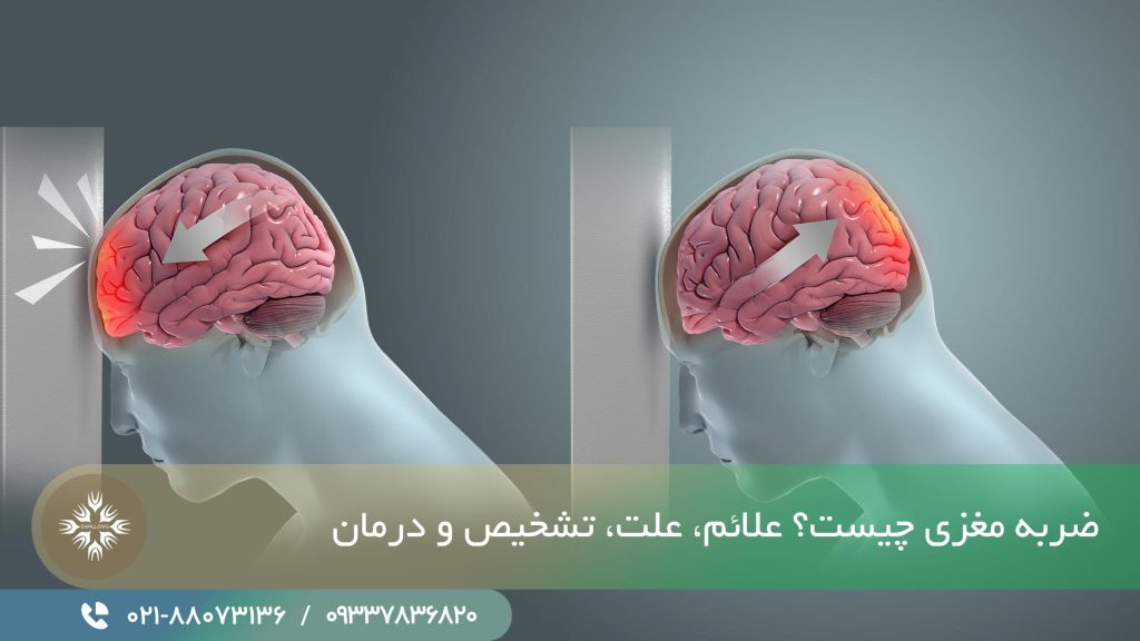 ضربه مغزی چیست