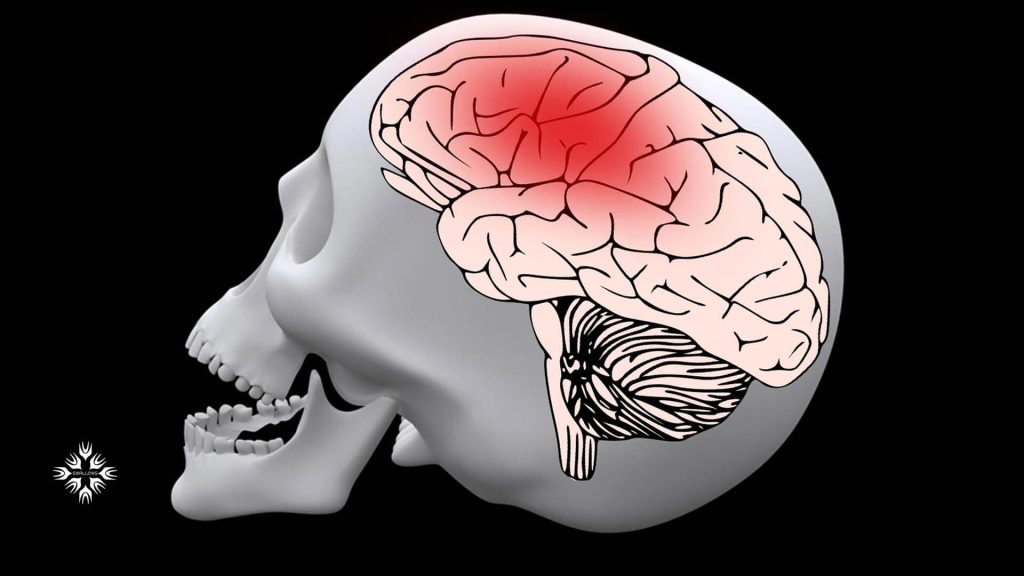 آیا ضربه مغزی باعث مرگ میشود