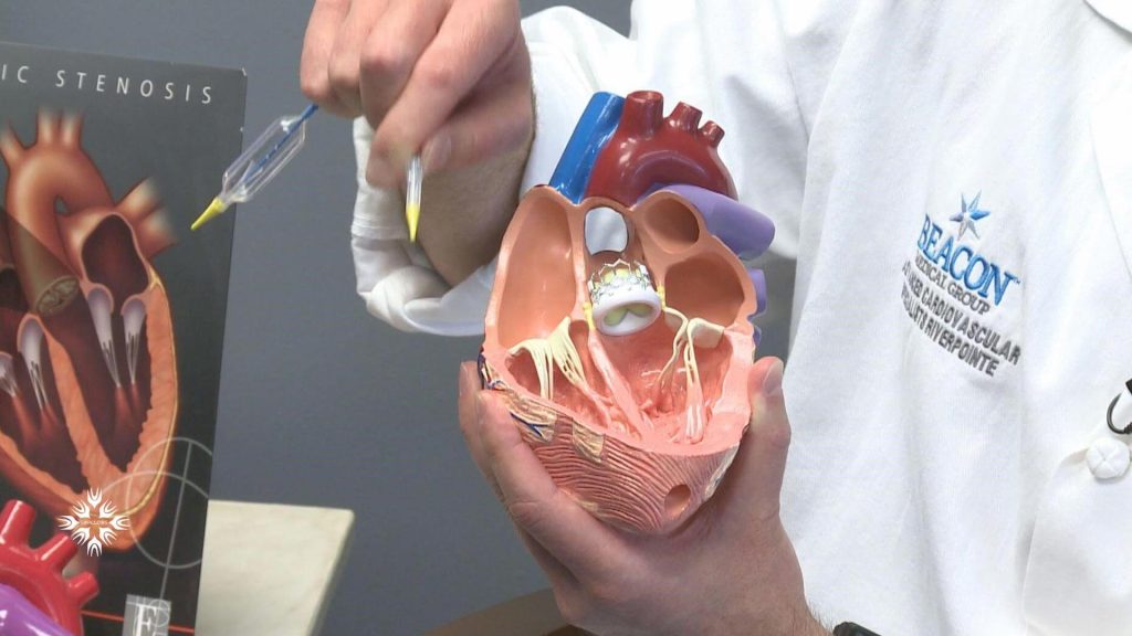 انواع جراحی دریچه قلب، ترمیم یا تعویض دریچه قلب