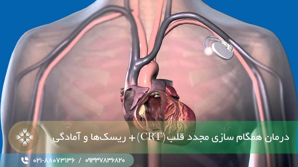 درمان همگام سازی مجدد قلبی (crt)