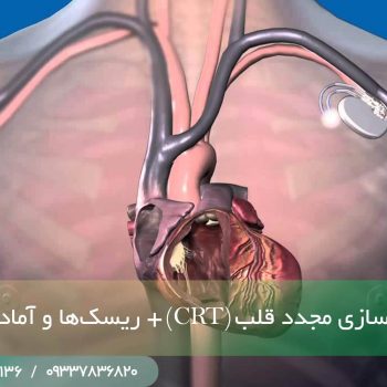 درمان همگام سازی مجدد قلبی (crt)