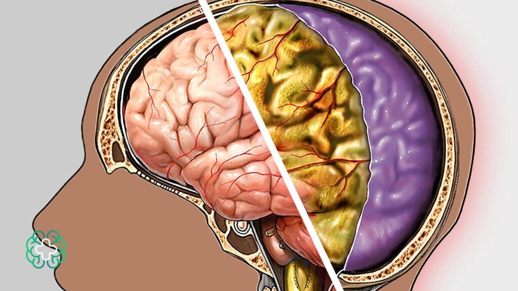 اختلالات مغزی چیست
