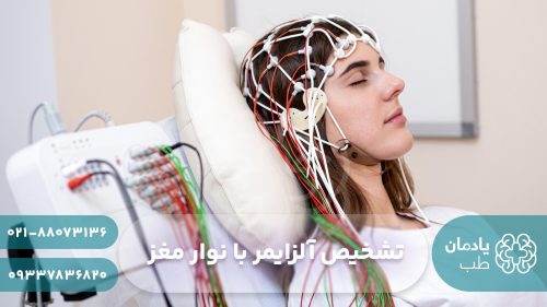 تشخیص آلزایمر با نوار مغز یا EEG