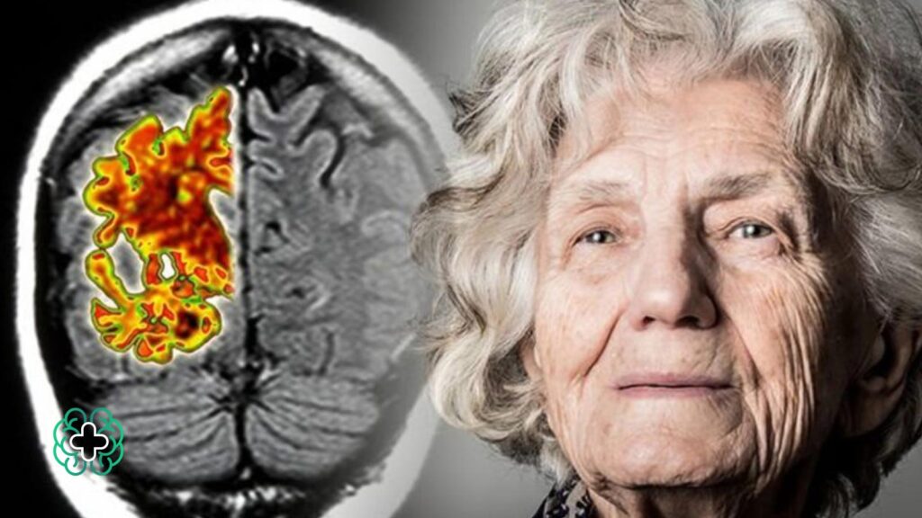 بیماری‌های عصبی در پیری چیست